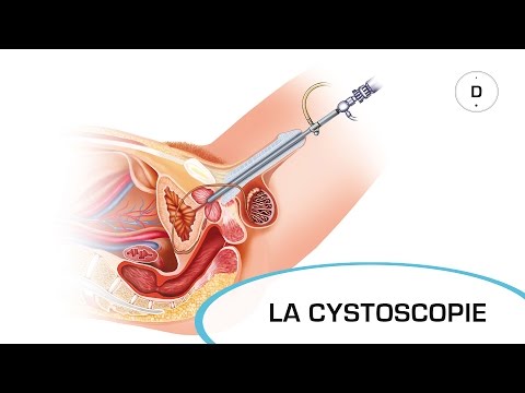 Fibroscopie urinaire : quand la réaliser et à quoi s&rsquo;attendre lors de l&rsquo;examen